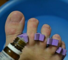 Ettevalmistused küünte töötlemiseks seenevastaste tilkadega